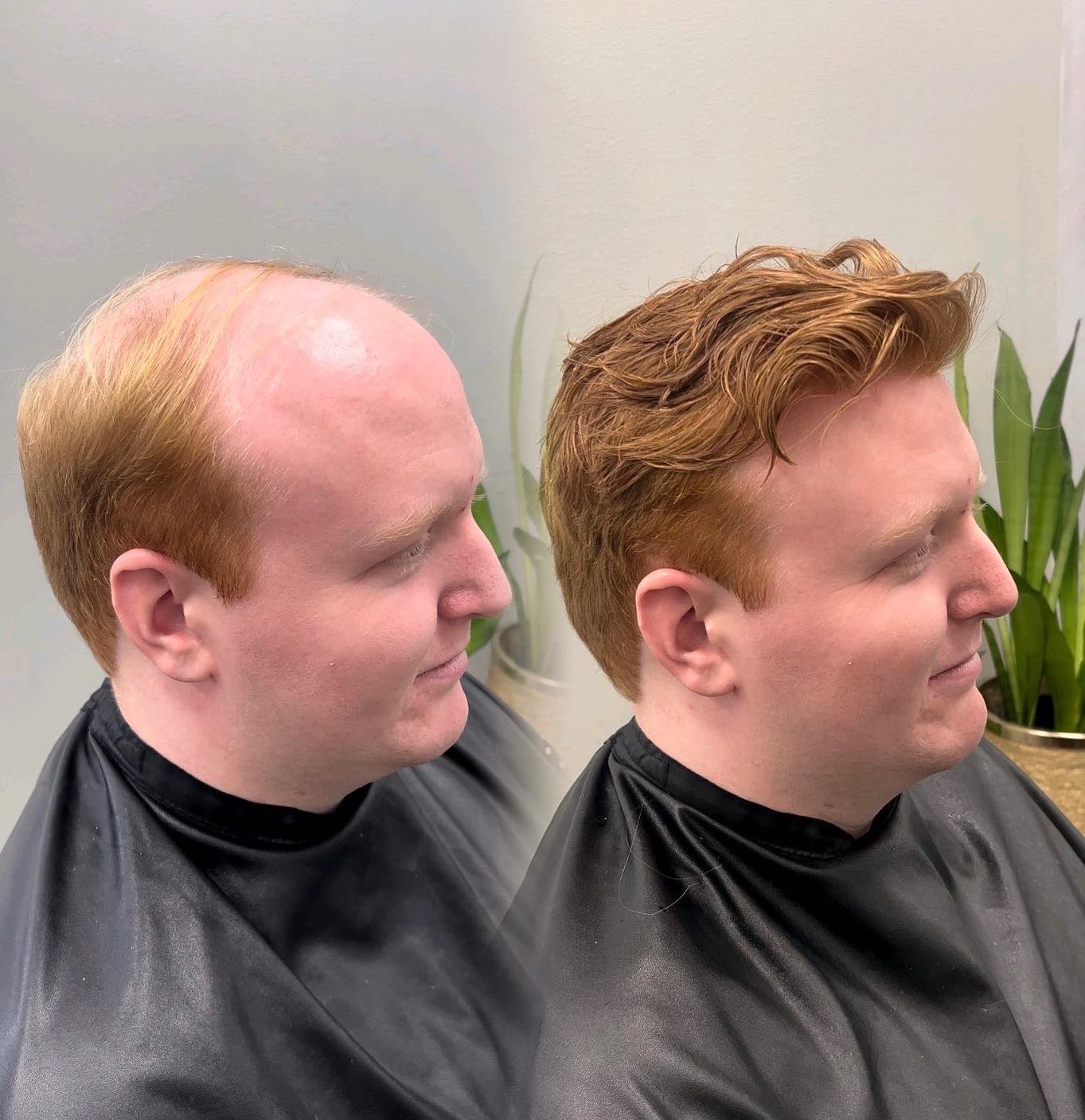 Red-haired client hair system before-and-after result in Taunton, Massachusetts