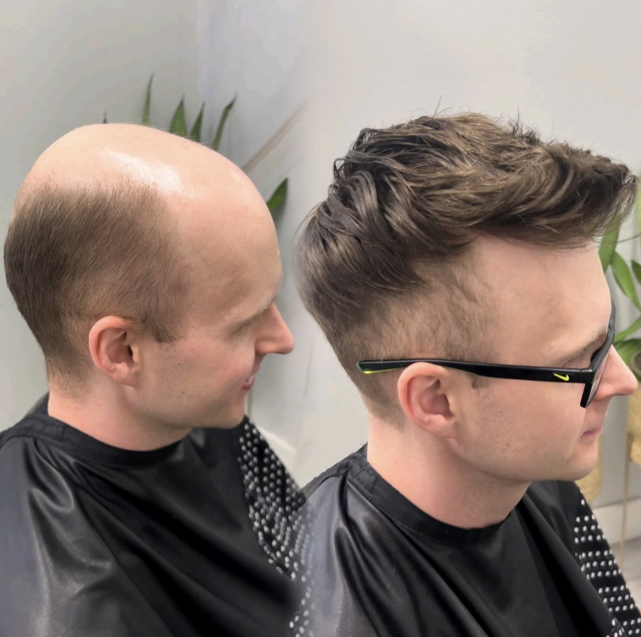 Before-and-after custom hair system result for a client in Taunton, Massachusetts